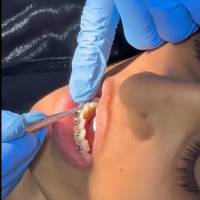 Treatments to Maintain Healthy Teeth