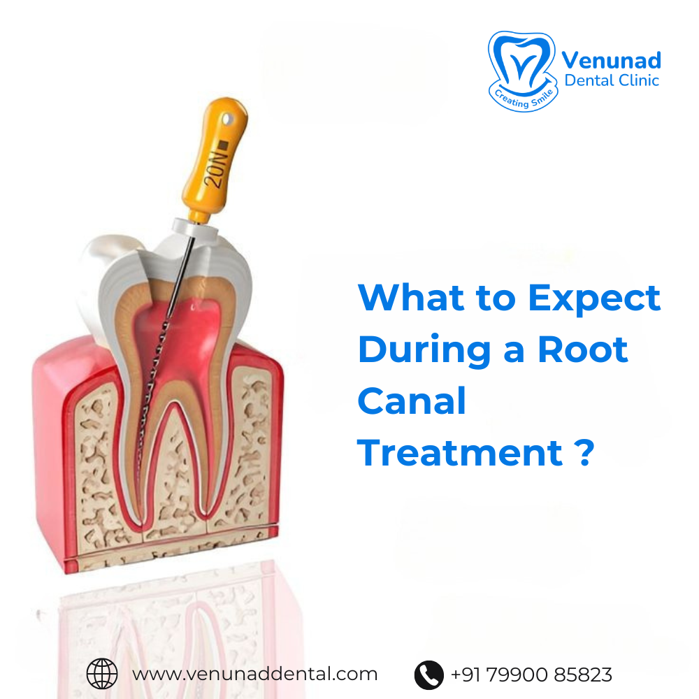 https://venunaddental.com.lttrbx.in/uploaded_file/files/img/news/Root Canal Treatment