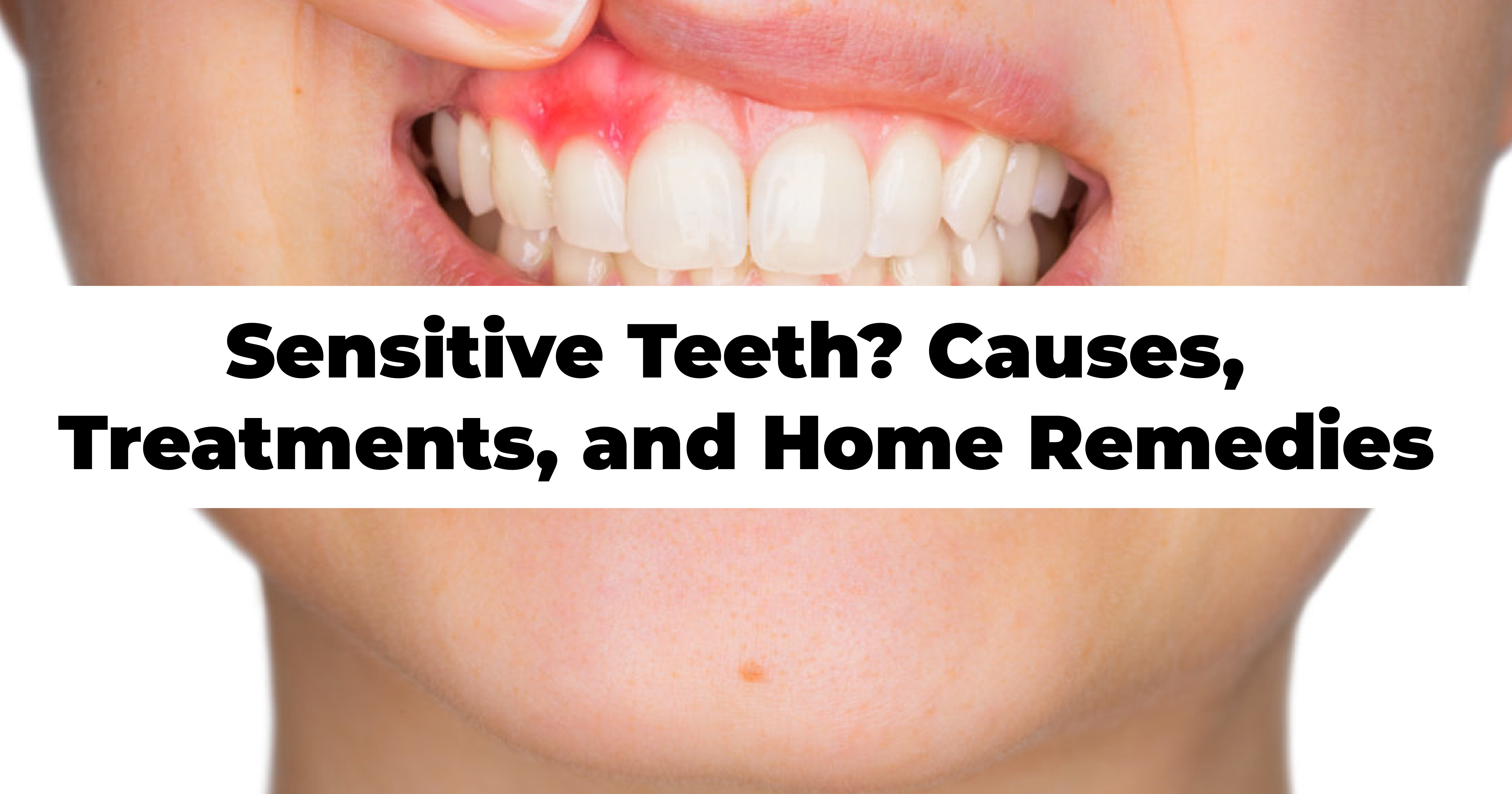 https://venunaddental.com.lttrbx.in/uploaded_file/files/img/news/Sensitive Teeth